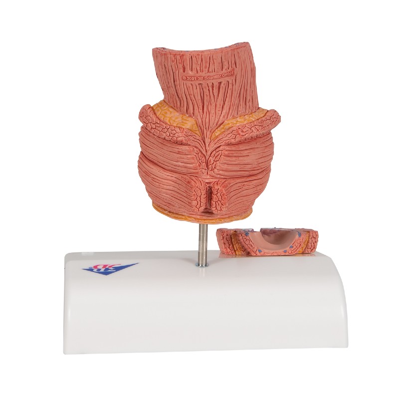 3B Scientific Rectum Model w/ Haemorrhoids | Health and Care